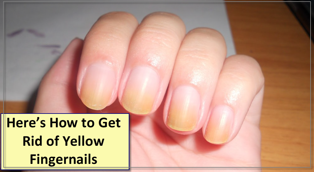 Here’s How to Get Rid of Yellow Fingernails
