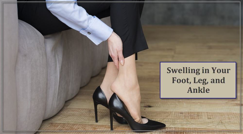 Swelling in Your Foot, Leg, and Ankle