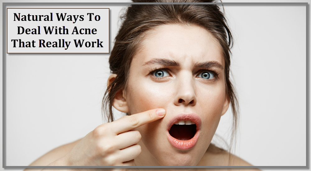 Natural Ways To Deal With Acne That Really Work