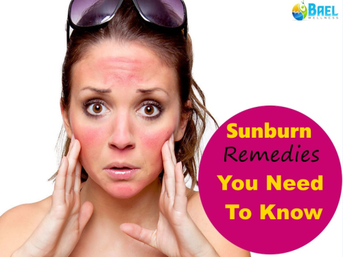Coolest Home ‪Remedies‬ For ‪‎Sunburn‬ You Need To Know.